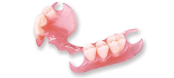 Prótesis Dentales Fijas